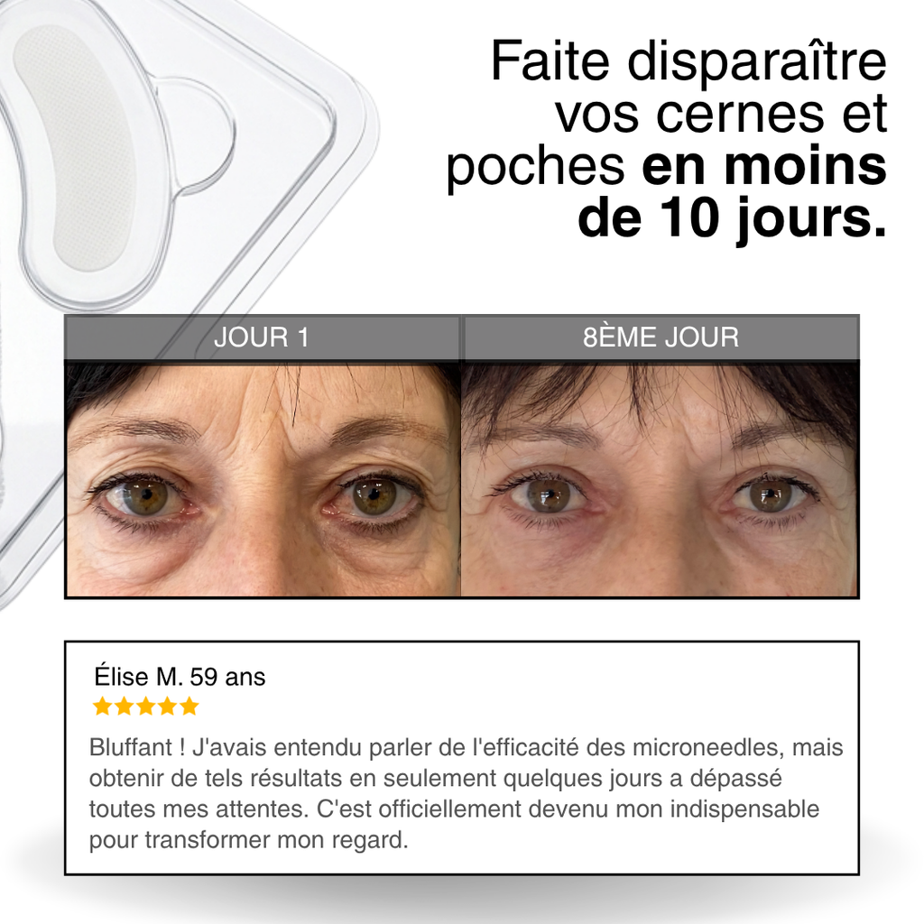 Patchs Anti-cernes microneedling